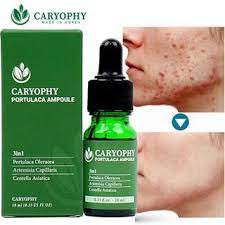 Serum ngăn ngừa mụn và thâm Caryophy Chính Hãng - Serum Mụn Ngăn Ngừa Mụn Ẩn,Mụn Đầu Đen