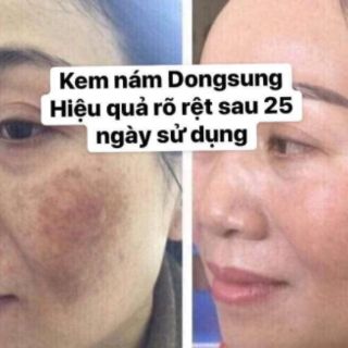 KEM NÁM DONGSUNG MẪU MỚI