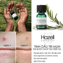 TINH DẦU TRÀM TRÀ THE BODY SHOP TEA TREE OIL