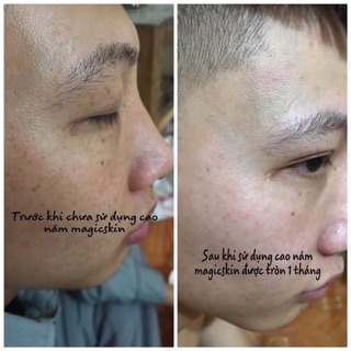 CAO NÁM MAGIC SKIN