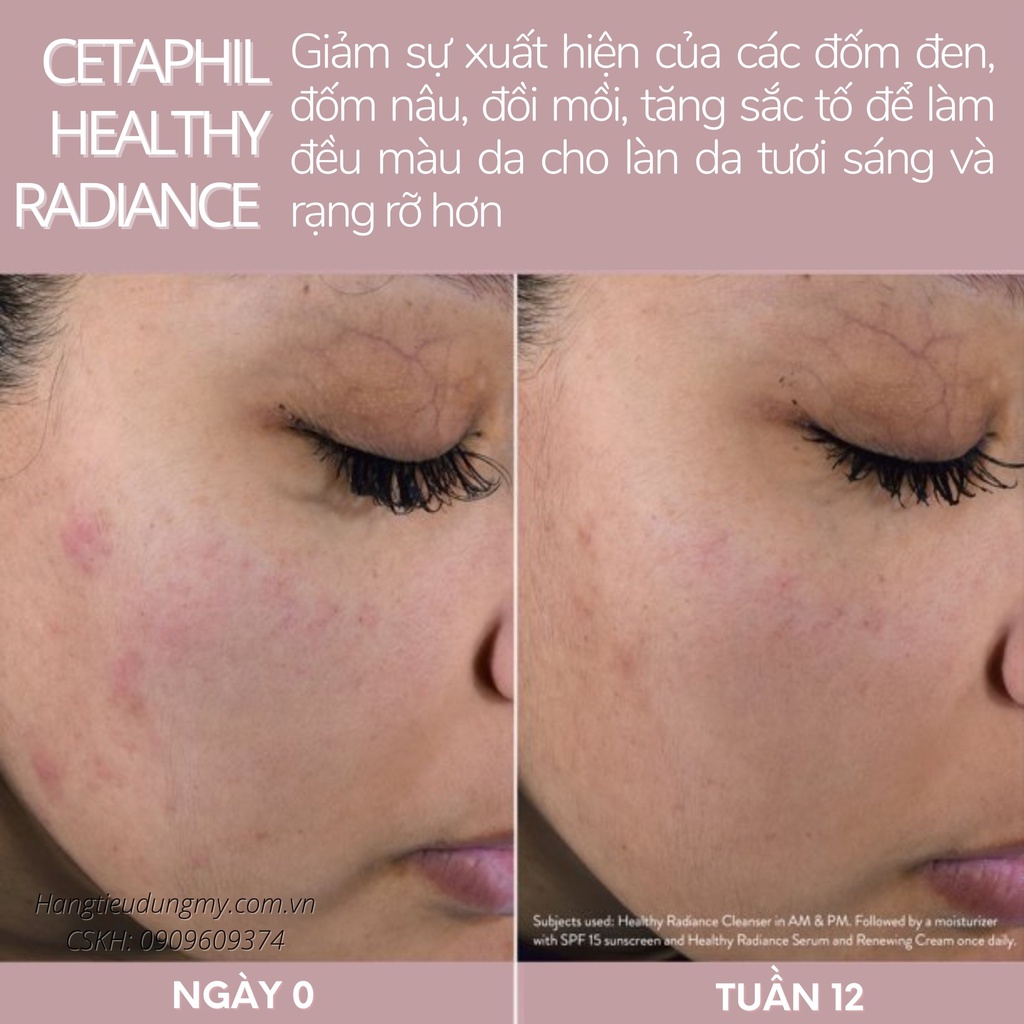 KEM DƯỠNG CETAPHIL HEALTHY RADIANCE ANTIOXIDANT-C|SÁNG DA KHỎE MẠNH, GIẢM VẾT THÂM, ĐƯỢC THIẾT KẾ CHO DA NHẠY CẢM,