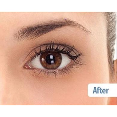 Kem Dưỡng Mắt Ngừa Lão Hóa Chiết Xuất Nọc Rắn Balance Active Formula Snake Venom Eye Cream 15ml | BigBuy360 - bigbuy360.vn