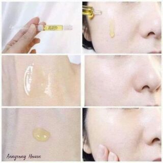Tế Bào Gốc ELDAS