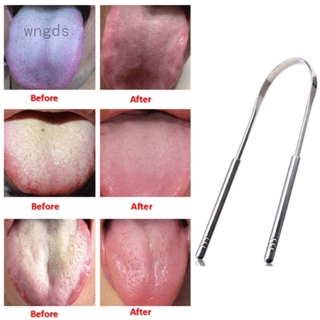 [Hàng mới về] Dụng Cụ Cạo Lưỡi Làm Từ Thép Không Gỉ Chăm Sóc Răng Miệng Sử Dụng Tiện Lợi