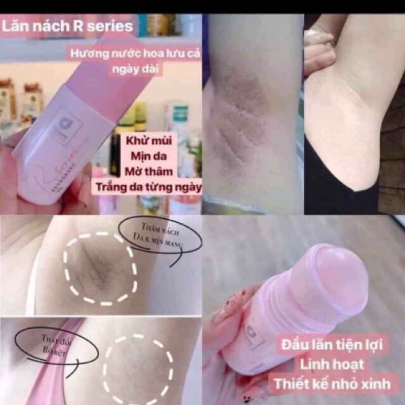 lăn nách khử mùi màu hồng hương nước hoa rseries thái lan hàng chuẩn | BigBuy360 - bigbuy360.vn