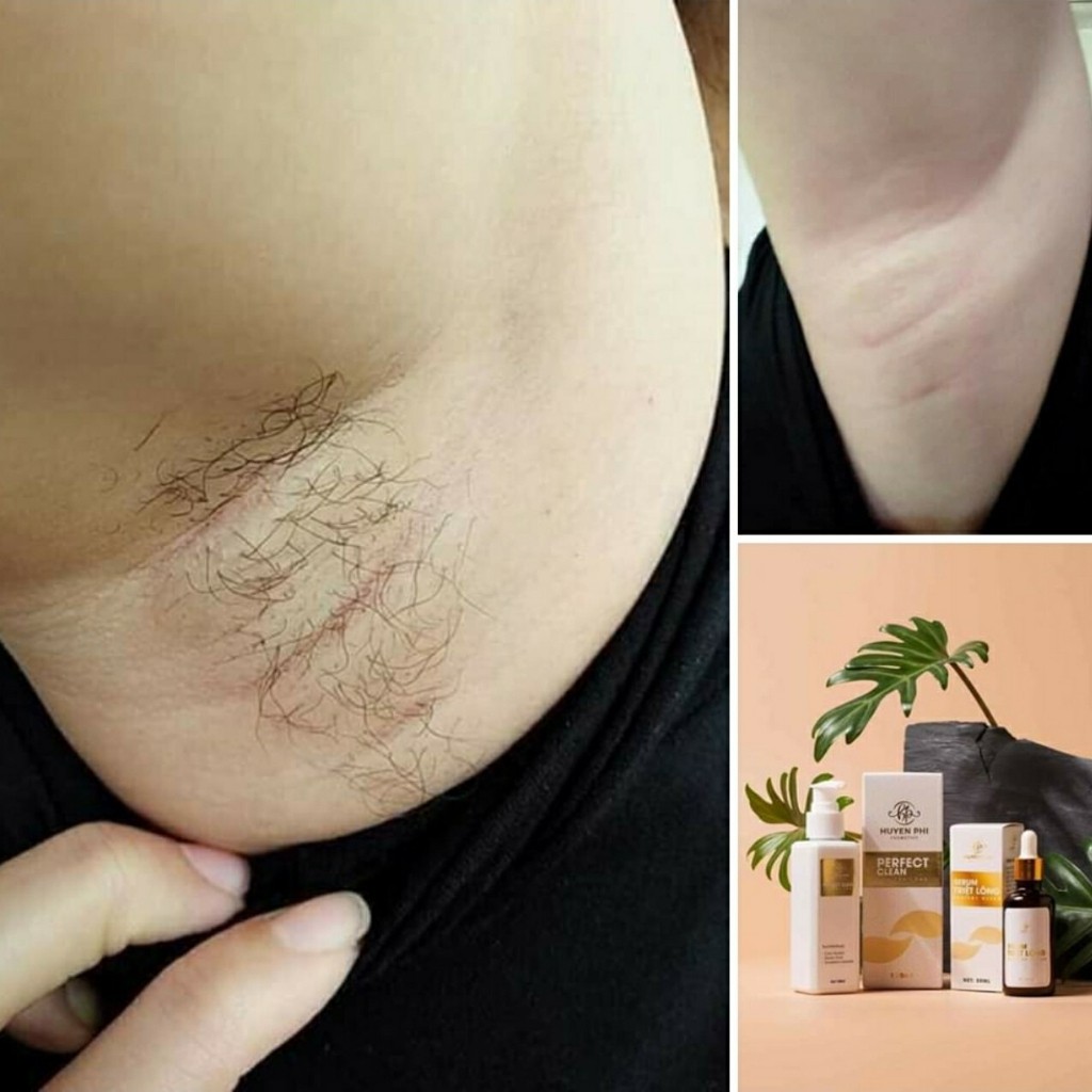 KEM TẨY LÔNG HUYỀN PHI + TẶNG SERUM TRIỆT LÔNG VĨNH VIỄN | BigBuy360 - bigbuy360.vn