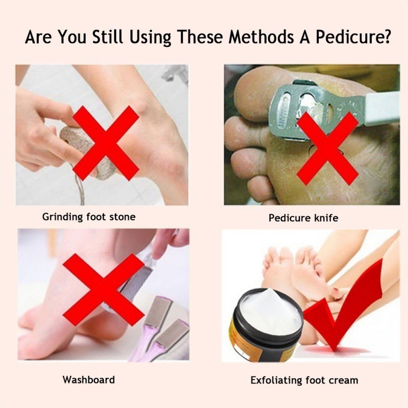Kem hỗ trợ giảm nứt nẻ gót chân từ mỡ ngựa giữ ẩm và cải thiện da