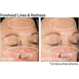 Kem dưỡng StriVectin Wrinkle Recode Moisture Rich Barrier Cream