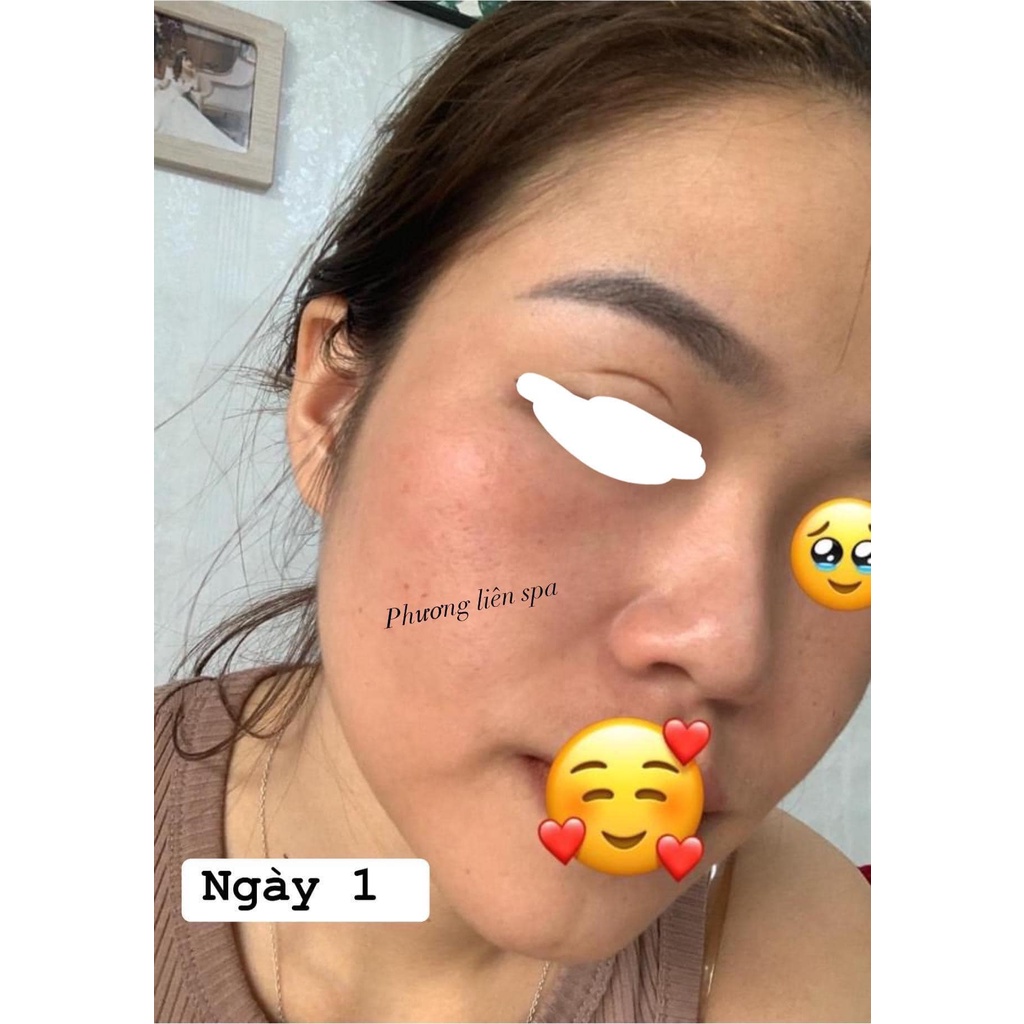 Bách y sâm 03 Plus 30ml Mẫu Mới Thượng Phẩm Tái Tạo Da Nuôi Da Từ Gốc