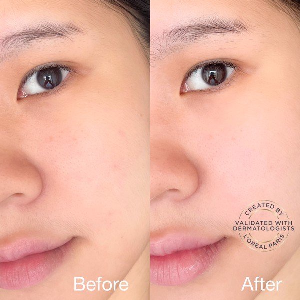 Dưỡng Chất Trắng Da Loreal Paris Glycolic-Bright Instant Glowing Serum 1.0% Glycolic Acid