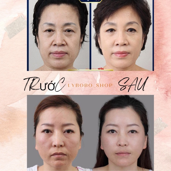 Vitamin E đỏ đẹp da chống lão hoá giảm sạm nám giảm nếp nhăn