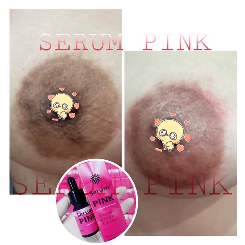 SERUM PINK - Dưỡng hồng nhũ hoa và bikini
