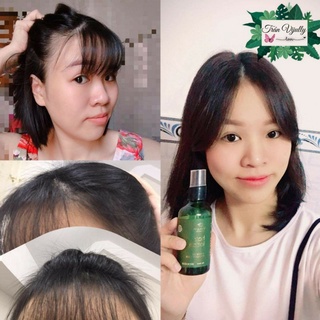 Tinh dầu bưởi kích mọc tóc Vijully