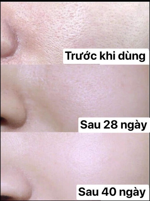 Serum Heyxi - tinh chất se khít lỗ chân lông hiệu quả | BigBuy360 - bigbuy360.vn