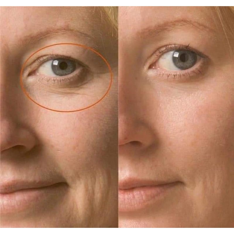 Retinal dr.Different nồng độ 0.05 và 0.1 mẫu mới | BigBuy360 - bigbuy360.vn