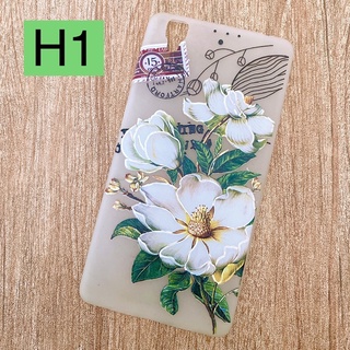 Ốp lưng Oppo R7s