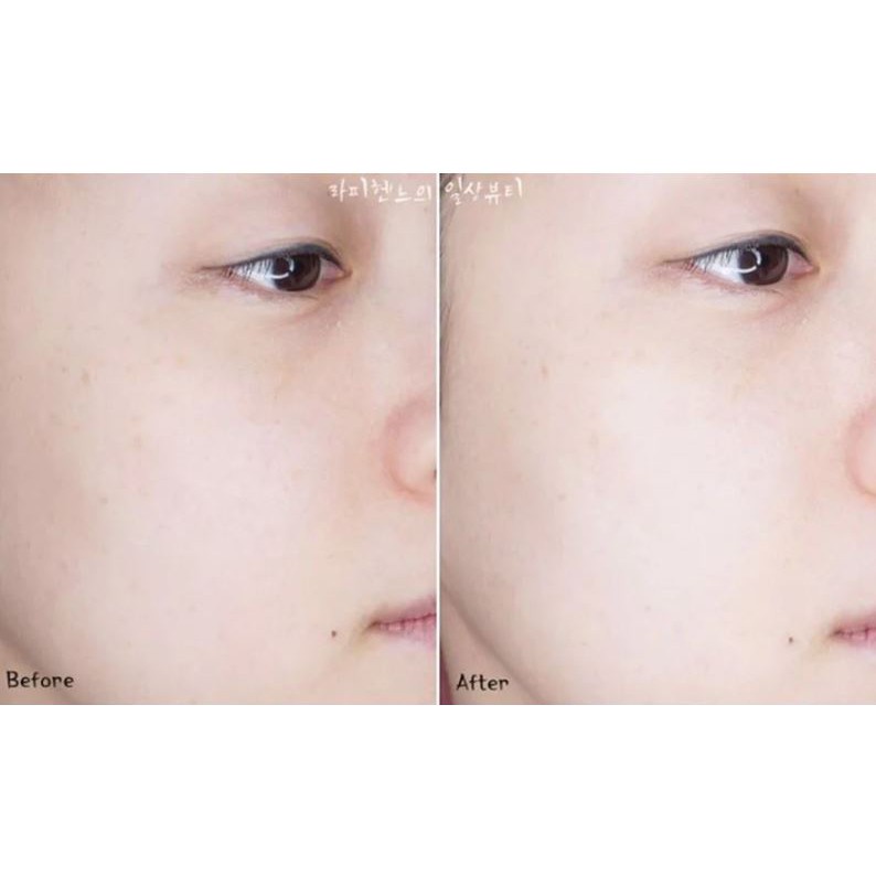 Nước Khoáng Làm Sạch Và Dịu Da La Roche-Posay Serozinc 300ml