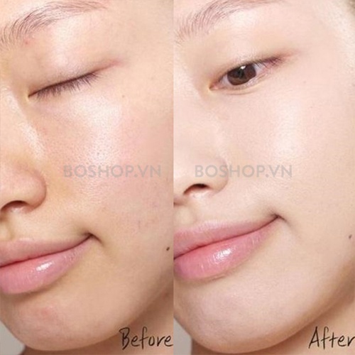 Tinh Chất Balance Active Formula Niacinamide Blemish Recovery Serum 30ml Giảm Mụn, Giảm Thâm - Leebangkok