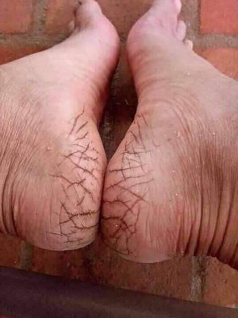 Kem thoa nứt gót chân Heel Spa - Thái lan