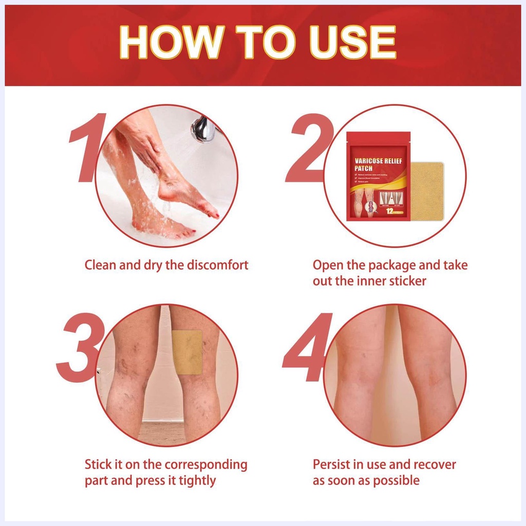 Miếng dán giảm giãn tĩnh mạch 12 miếng sửa chữa tĩnh mạch chân phồng lên bằng giun đất sưng đau chân