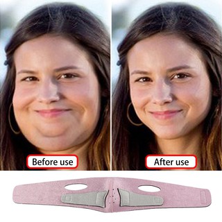 Mặt nạ định hình giúp điều chỉnh mặt V line