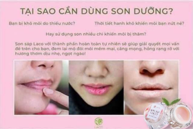 [ Rẻ vô địch ] SON SÁP LACO DƯỠNG HỒNG VÀ CHỐNG THÂM MÔI | BigBuy360 - bigbuy360.vn