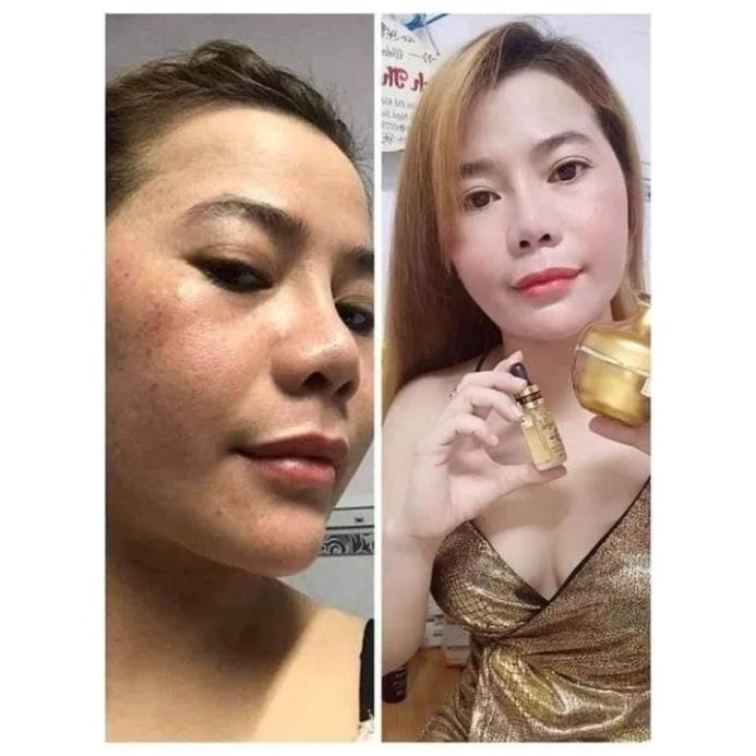 Combo Kem Face Nhân Sâm + Serum Skin Care Vitamin C