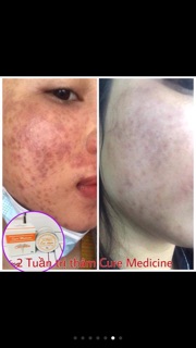 Cao thâm fourets cosmetics
