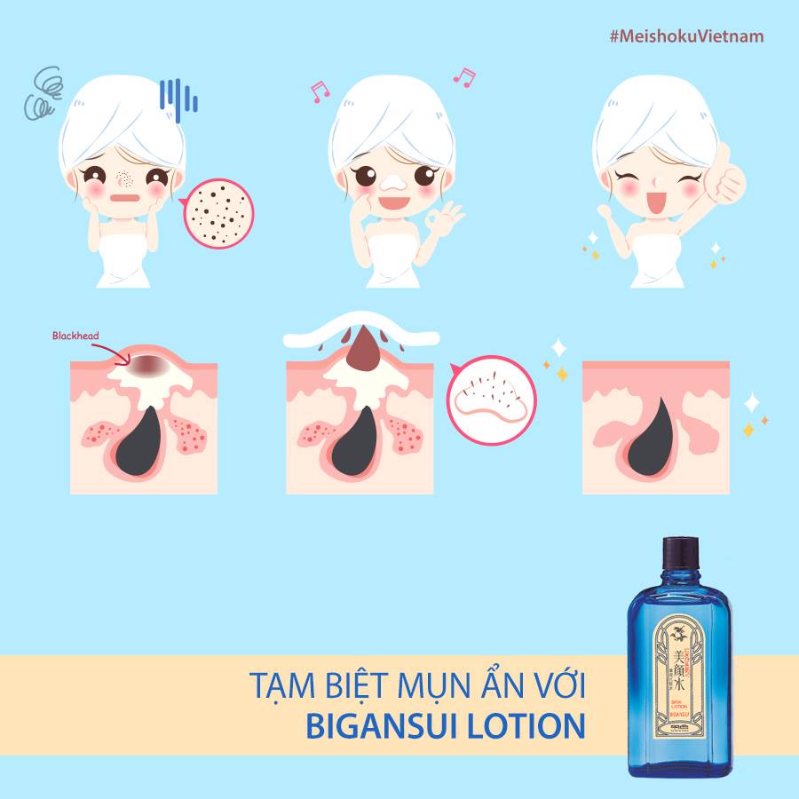 Lotion giảm mụn BIGANSUI MEISHOKU Nhật Bản | BigBuy360 - bigbuy360.vn
