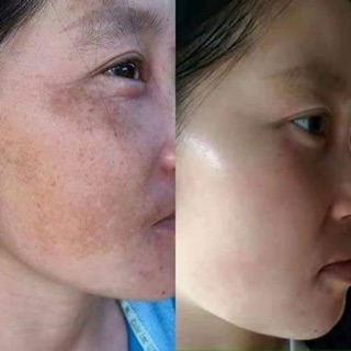 1bộ collagen plus vit e