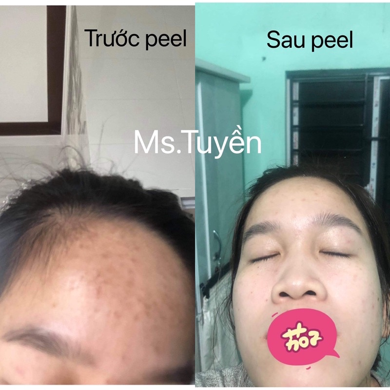 vi tảo sinh học set lẻ | BigBuy360 - bigbuy360.vn
