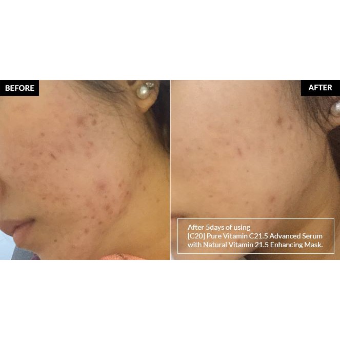 Tinh chất Dưỡng Da By Wishtrend 30ml