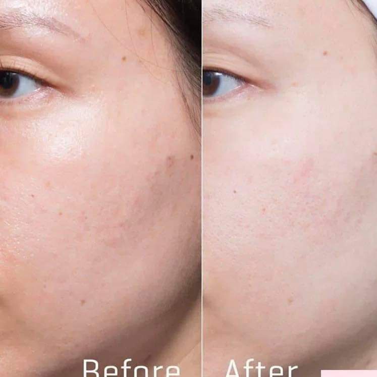 Tinh chất Serum siêu cấp ẩm và phục hồi da Medik8 Hydra8 B5 Serum 10ml, 30ml, 60ml