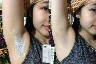 Tẩy lông Hesa doctor A