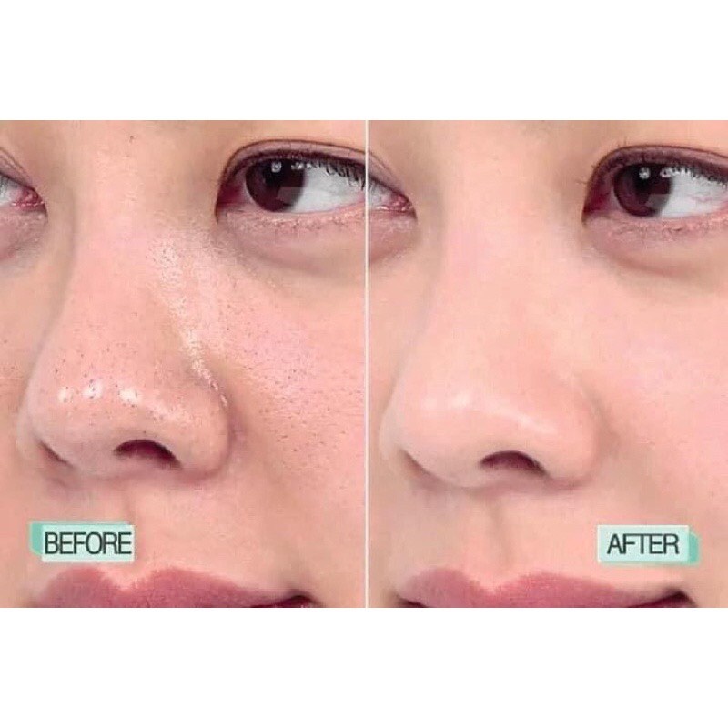 Serum Se Khít Lỗ Chân Lông Z.O Instant Pore Refiner Giúp Da Săn Chắc Mịn Màng