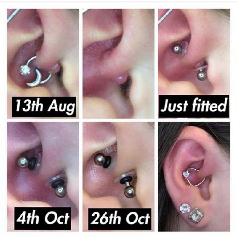 Miếng Nopull Disc - NẸP BUMP CHÍNH HÃNG - Miếng nẹp bump / Đệm siết - Nẹp bump tai, mũi, rốn, môi, septum,...