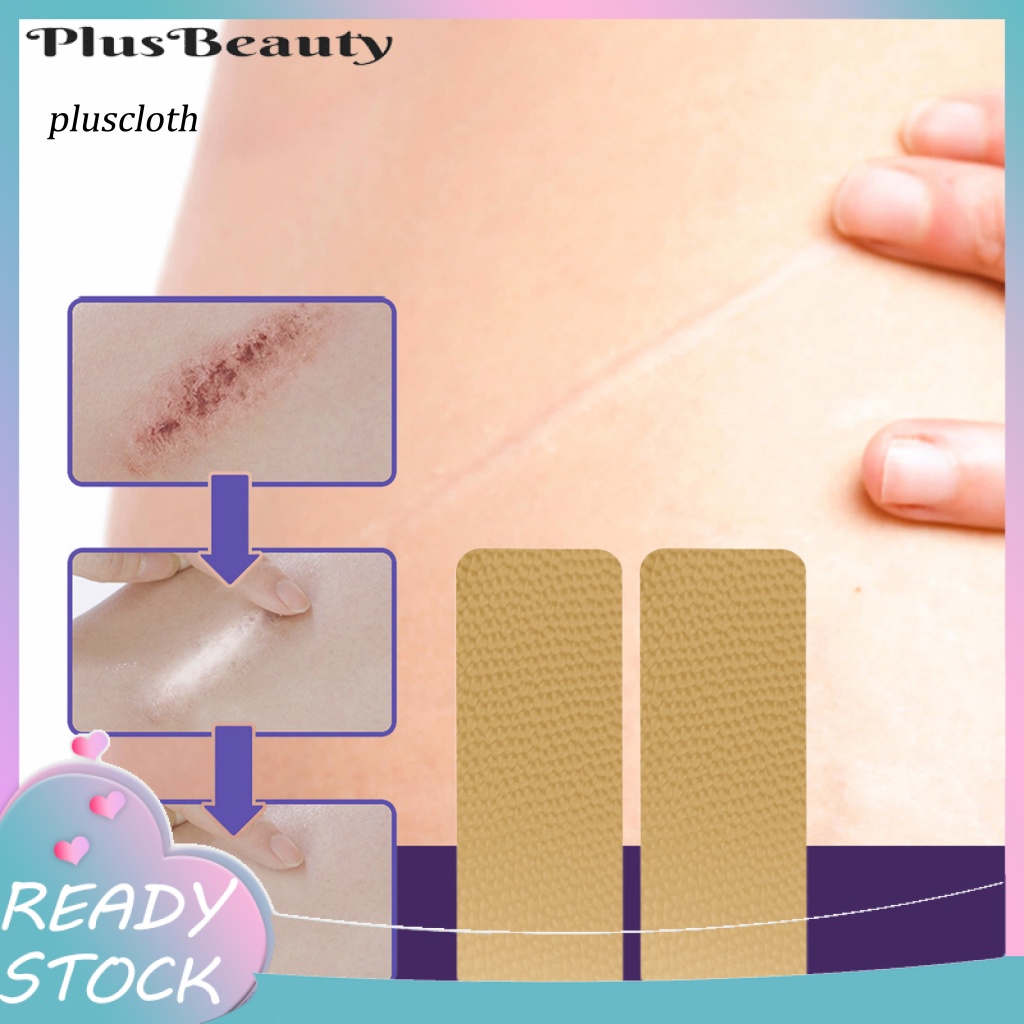Miếng Dán Hỗ trợ giảm sẹo Siêu Mỏng Chất Lượng Cao