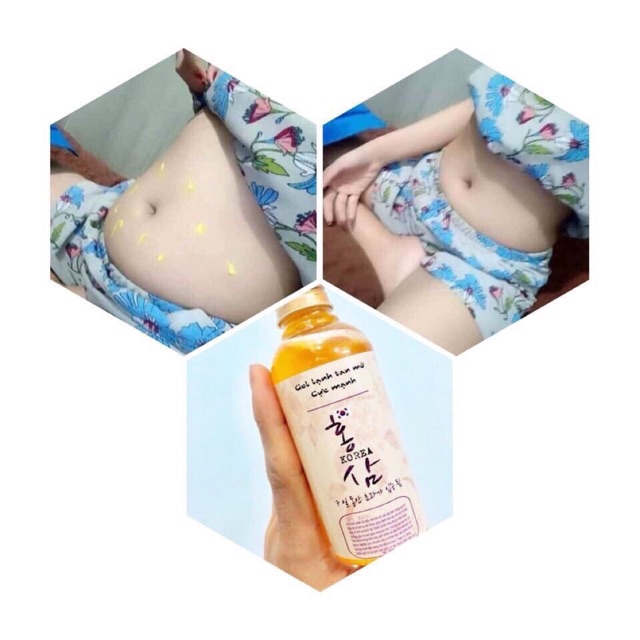 Kem bôi tan mỡ