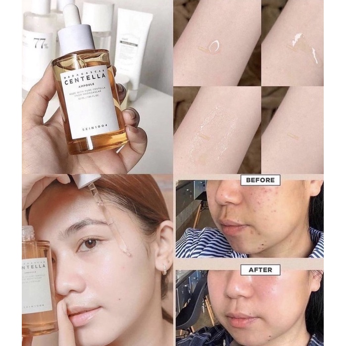 Tinh Chất Rau Má Skin1004 Madagascar Centella Ampoule Serum