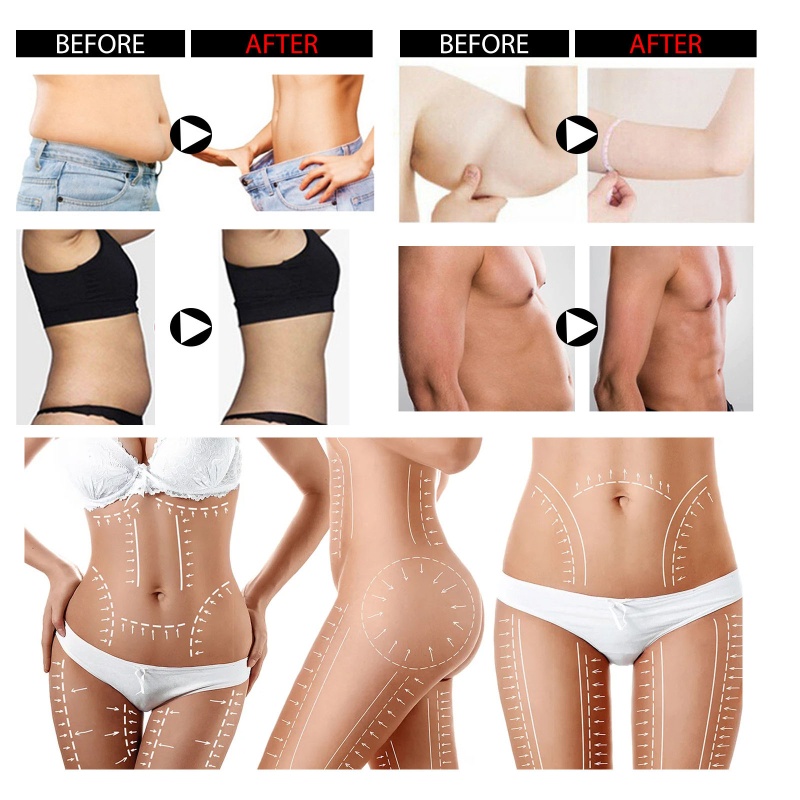 Xà Phòng Tắm Làm Sạch Sâu Chống Cellulite