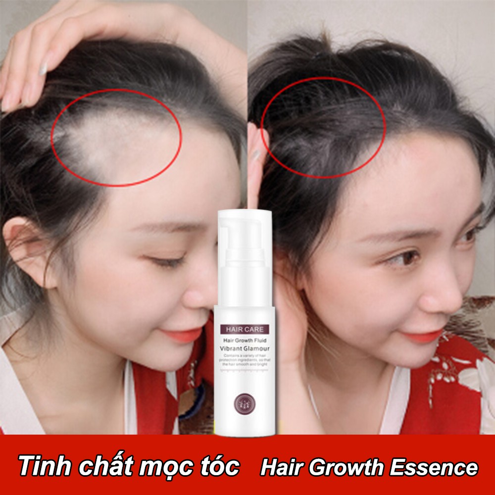Tinh chất mọc tóc, ngăn ngừa rụng tóc, chai tinh dầu giúp tóc mọc nhanh hơn, hiệu quả hơn,Tinh chất ngăn ngừa rụng tóc cho nam và nữ