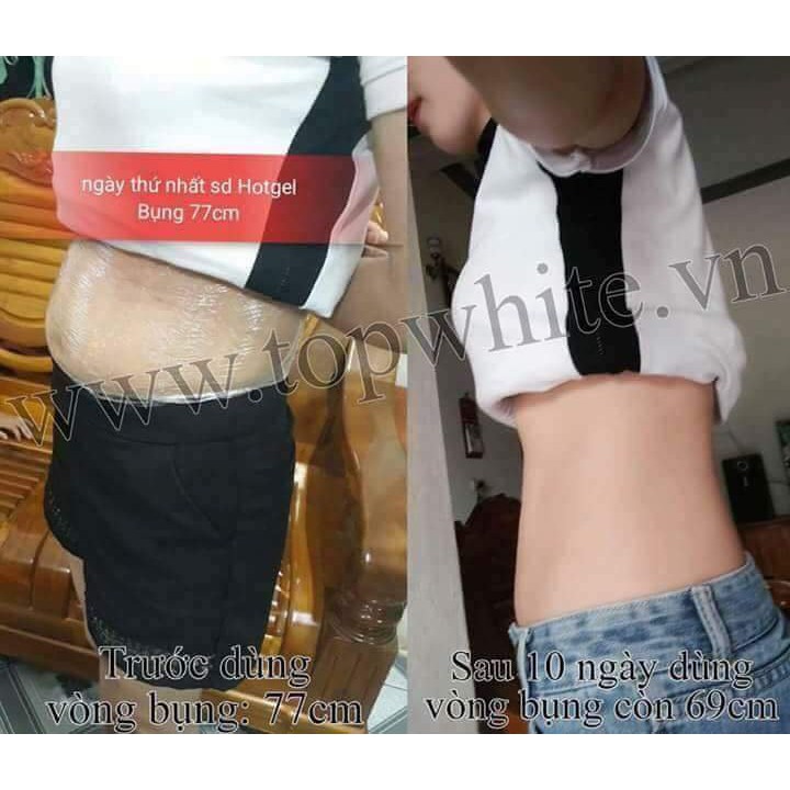 Kem tan mỡ Hot gel Re-Perfect Body