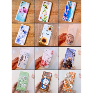 Ốp Vsmart active3