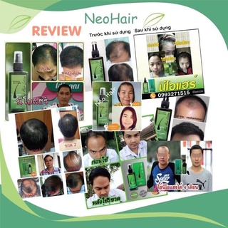 MỌC TÓC Thái Lan Neo Hair Lotion