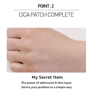 [VT] Spot Patch 12 / 48 Miếng dán / Miếng dán mụn / Miếng dán mụn trứng cá _ Jul