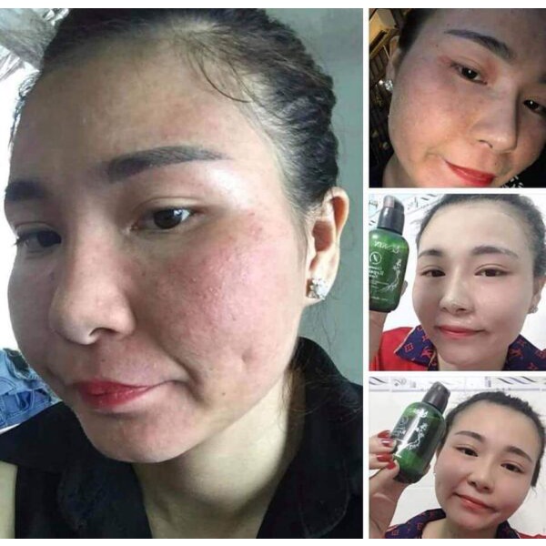 Serum Thay Da Nhân Sâm MQ Skin Chính Hãng - 100ml