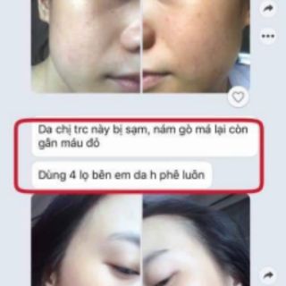 [ Hàng Chuẩn Cty ] Serum 7 Day Olic 10ml