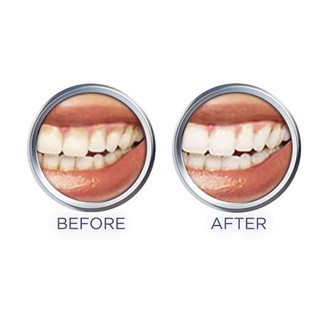 Kem Đánh Răng Crest 3D White Advanced Whitening 158g