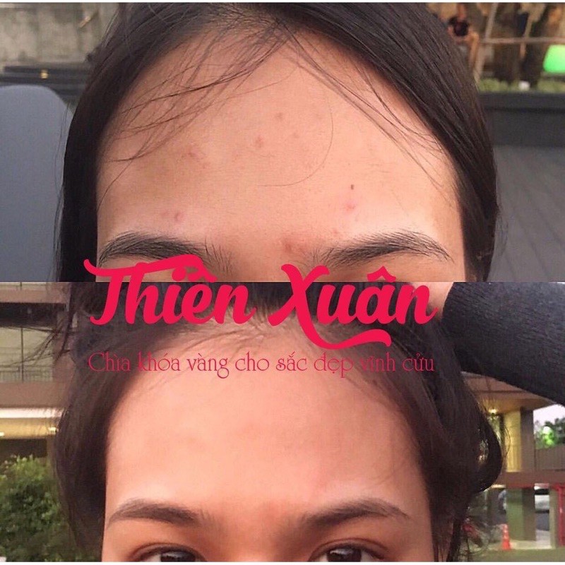 THIÊN XUÂN BỘT UỐNG TRẮNG DA THẦN TỐC TẶNG KÈM SAFFRON | BigBuy360 - bigbuy360.vn