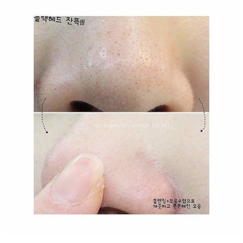 Sáp giảm mụn đầu đen INNSFREE JEJU VOLCANIC BLACKHEAD OUT BALM